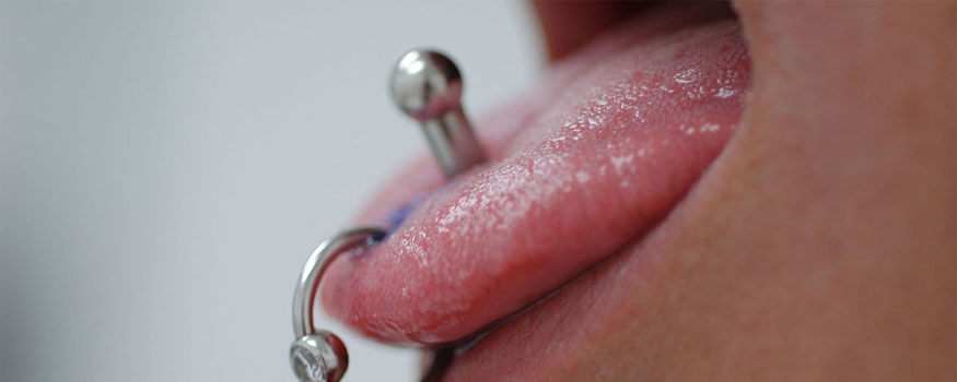 Piercing jezika: Prijetnja oralnom zdravlju?