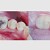 Srebrni ili bijeli zubni ispuni: Vi odlučujete