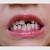kako postupiti u slučaju izbijanja zuba ?